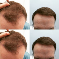 Picture1 Picture1