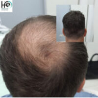 patient-X-13months patient-X-13months