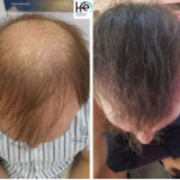 patient-X-16months patient-X-16months